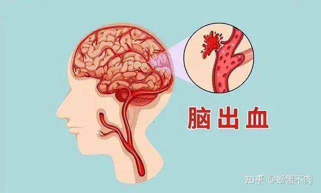 高血压的危害你注意了吗？